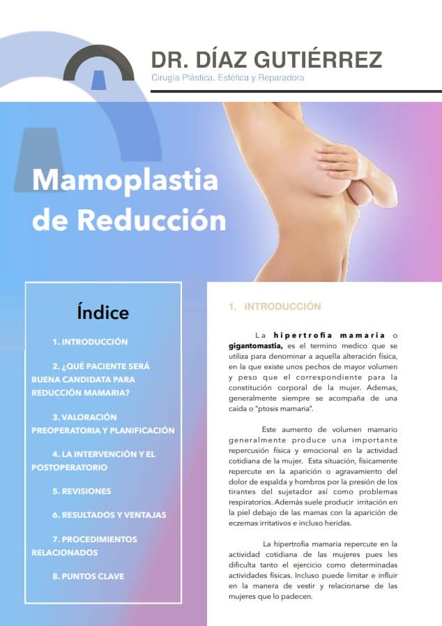 mamoplastia-de-reduccion-folleto