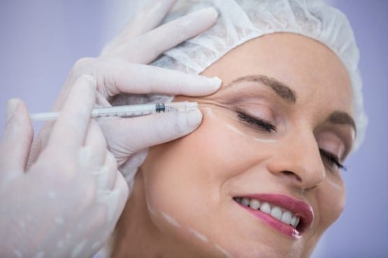 Mitos sobre el Botox