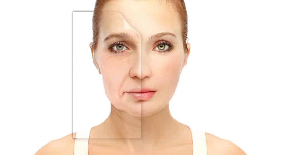 lifting facial deep plane