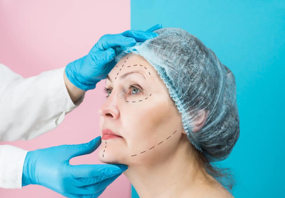 cirugía facial completa
