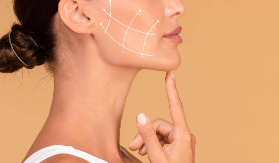 lifting cervicofacial