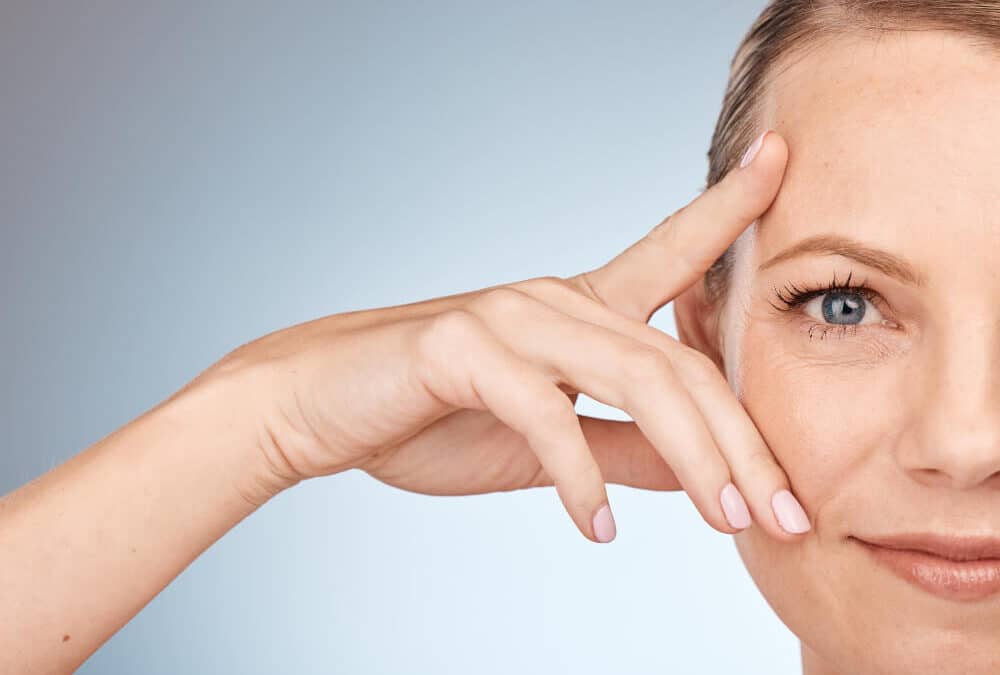 resultados de un lifting facial