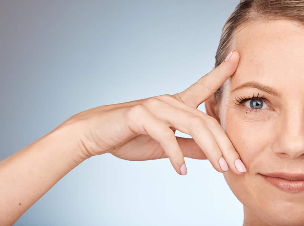 resultados de un lifting facial